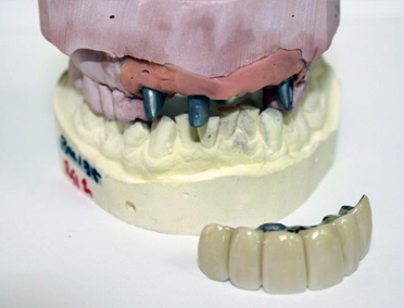 Dentals and Partials